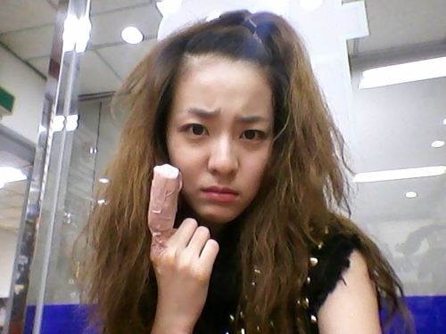 صورة ساندارا بارك أصيبت بحرق من الدرجة الثانية.. والسبب هو الرامين؟