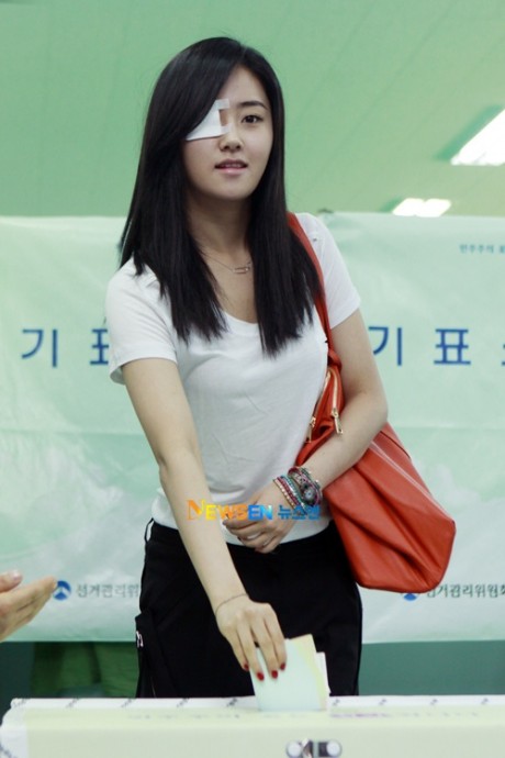 صورة كيف أصيبت غايون في عينها؟