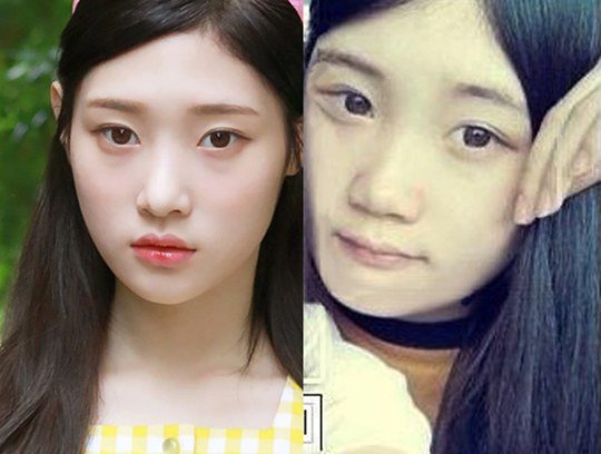 صورة [الآراء] زميلة جونغ تشايون في الصف تنشر لها صورة قديمة لتبديد شائعات حصولها على عملية جفون مزدوجة