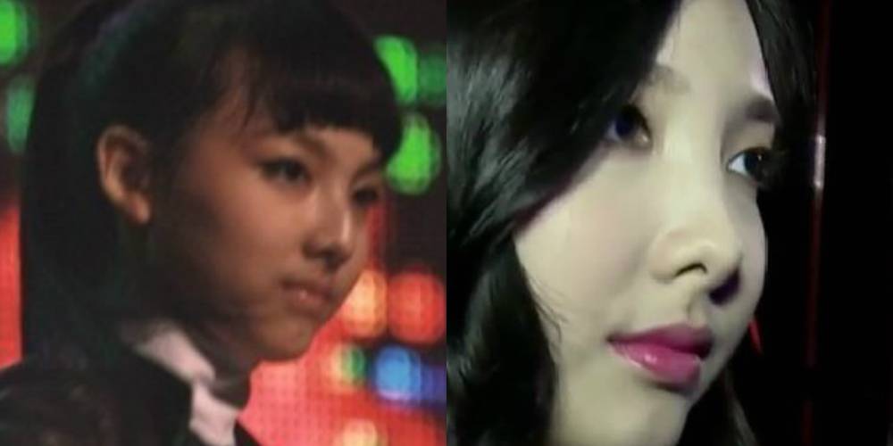 صورة مستخدمي الإنترنت أخرجوا دليل يدعم مزاعمهم بأن نايون من توايس أجرت عملية تجميل للأنف