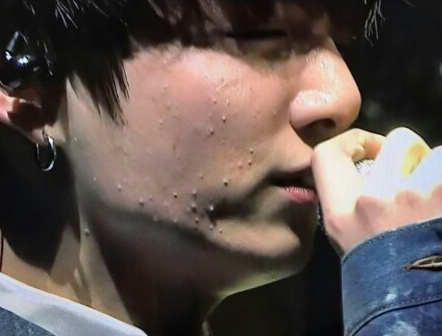 صورة مستخدمي الإنترنت عبّروا عن قلقهم على بشرة جونغكوك عضو فرقة بانقتان