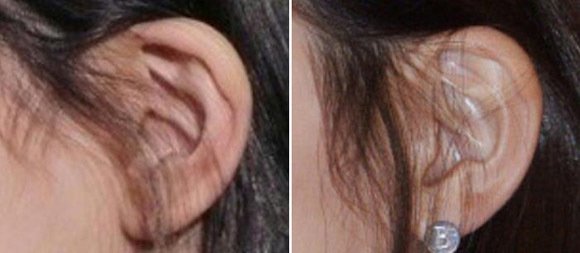 صورة [الآراء] سوزي تخسر وزنا حتى في أذنها؟