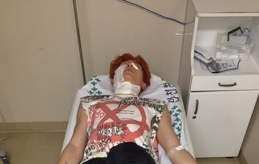 صورة [الآراء] كيسوب عانى من حروق من الدرجة الثانية بعد وقوع إنفجار في موقع تصوير الفيديو كليب