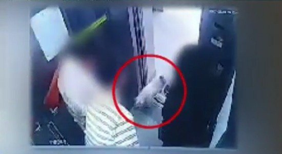 صورة [الآراء] تم الكشف عن فيديو كاميرا المراقبة لحادثة عض كلب شيون للضحية